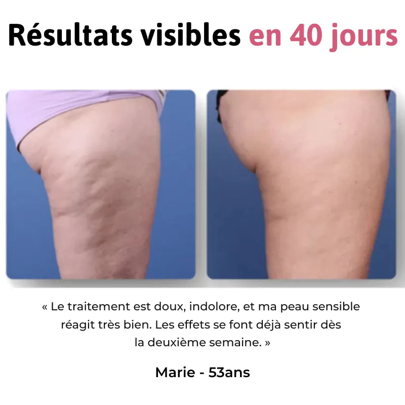 Sovelya Lift | Masseur drainant et raffermissant