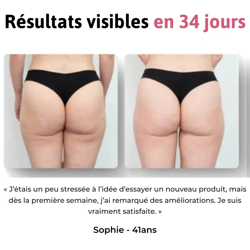 Sovelya Lift | Masseur drainant et raffermissant